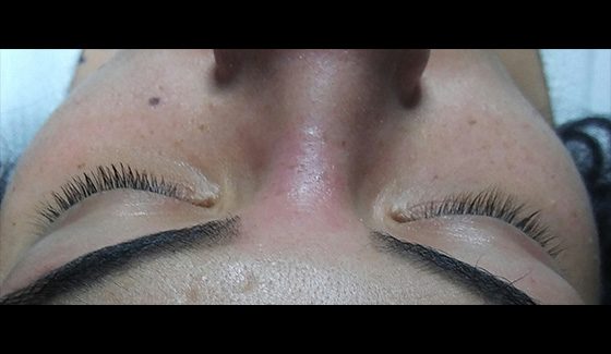 Before Lash Extensions